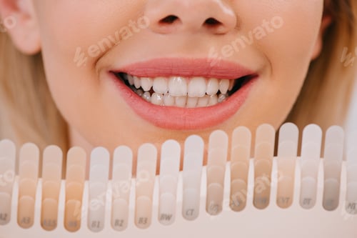 Preview: cropped view of smiling woman holding teeth color palette, teeth whitening concept