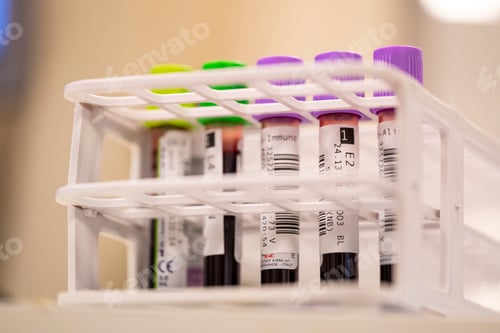 Preview: Close-up of a rack holding blood sample vials with colored caps in a laboratory.