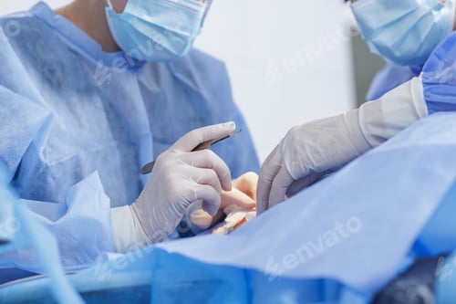 Preview: Surgeons Operate with Scalpel in Surgical Room