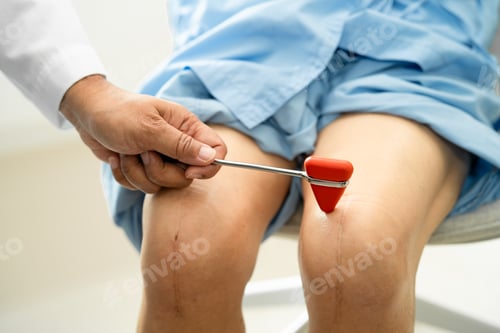 Preview: Asian doctor physiotherapist examining, massaging and treatment knee
