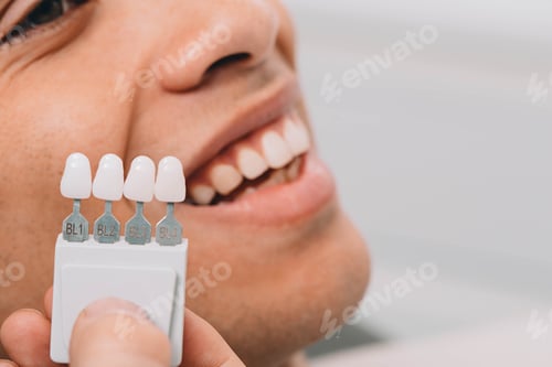 Preview: Dentist sampling shades teeth ,he holding teeth shades palette near male mouth. Whitening teeth