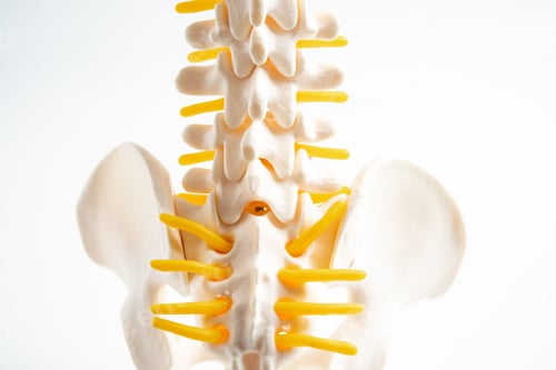 Preview: Lumbar spine displaced herniated disc fragment, spinal nerve and bone.