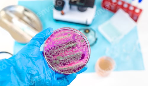 Preview: Examine bacteria in petri dishes in the laboratory. Selective focus.