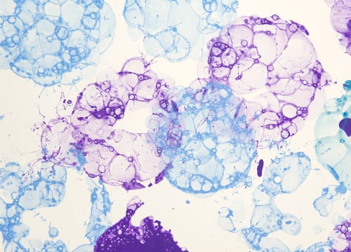 Preview: Closeup of the foam bubbles