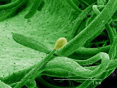 Preview: Sticky hair on Sundew leaf, Droscera sp SEM