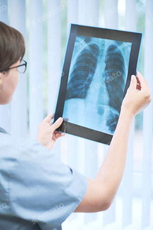 Preview: Indicating presence of pneumonia on lungs x-ray image