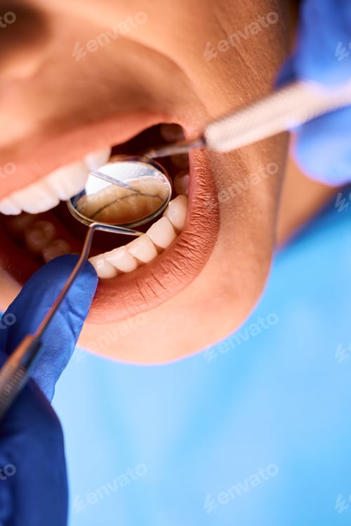 Preview: Close up of dentist examining teeth of a woman at dental clinic.