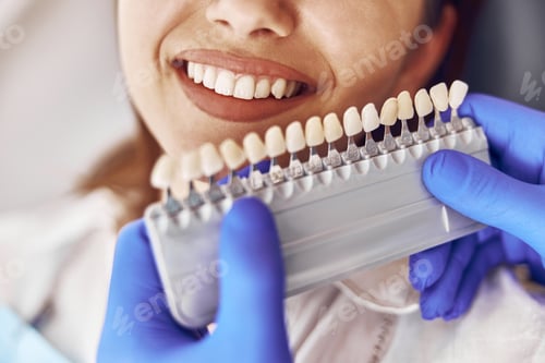 Preview: Professional doctor is choosing a colour of teeth in modern dental clinic