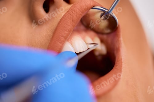 Preview: Close up of woman having her teeth examined by a dentist.