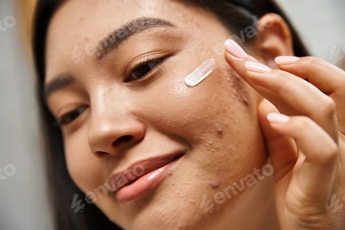 Preview: close up shot of young asian woman with brunette hair applying acne treatment cream on face