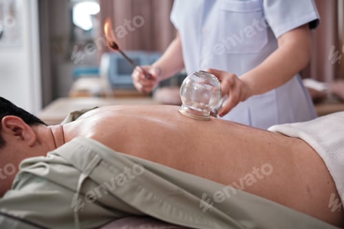 Preview: A cupping therapy for pain relief by physical therapist, oriental treatment.