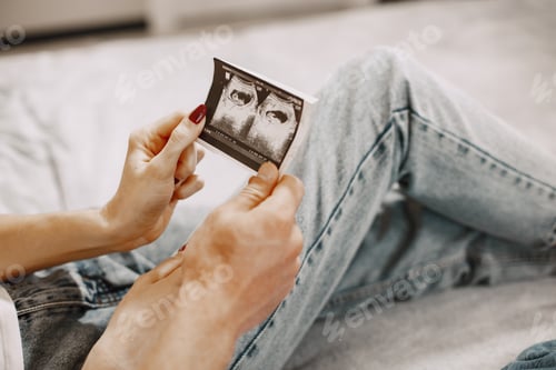 Preview: Couple look to ultrasound dignosticsphoto