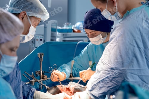 Preview: Surgeons Working in Operating Room During an Operation