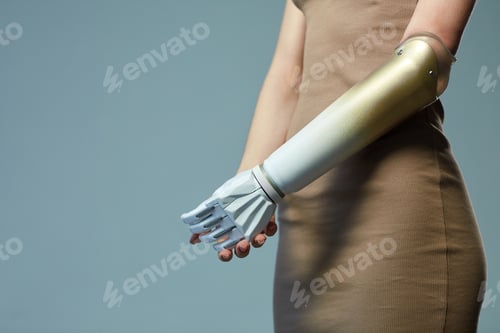 Preview: Young girl having prosthetic arm