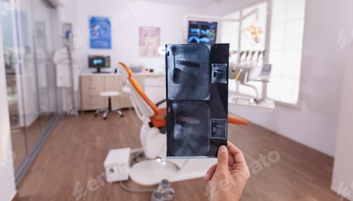 Preview: Orthodontist man doctor holding teeth medical radiography planning healthcare teethcare treatment