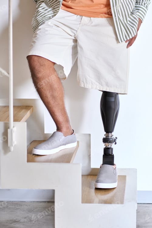 Preview: Amputee man with above knee leg prosthesis standing on feet, close up.