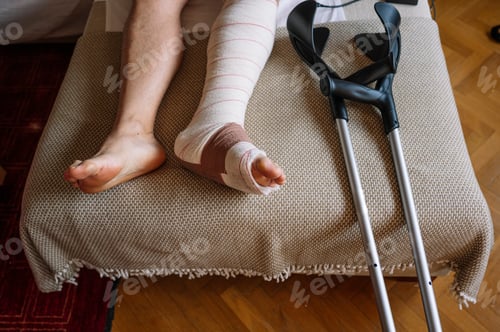Preview: Fractured foot with a bandage made by a doctor.