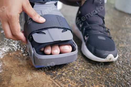Preview: women broken feet with a grey plastic boot ankle brace injury protecting boot