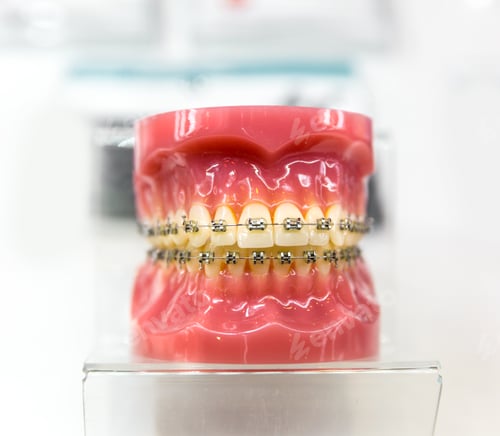 Preview: Dental equipment, orthodontic, denture closeup