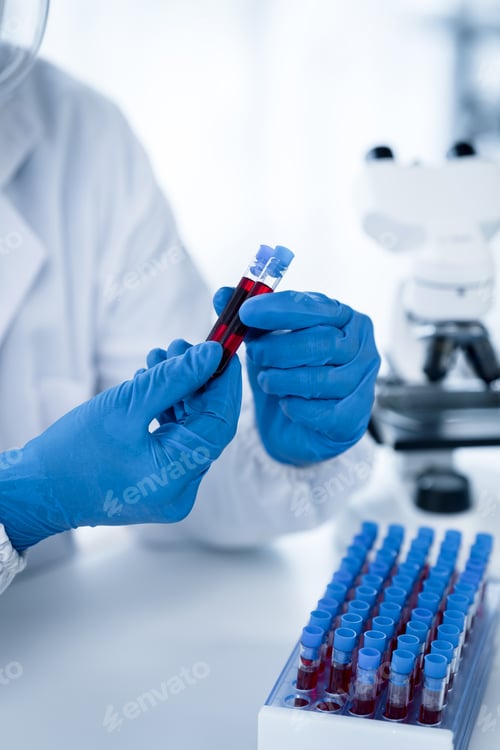 Preview: Doctor hand taking a blood sample tube from a rack with machines of analysis in the lab background