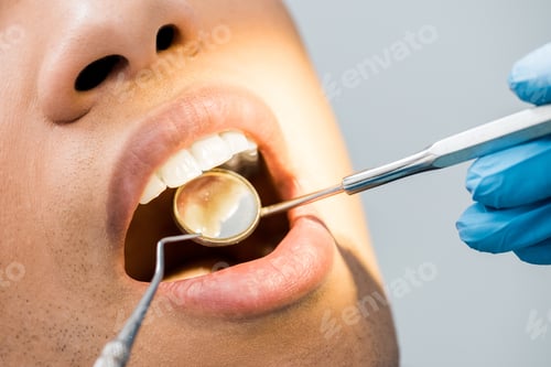 Preview: cropped view of african american man with open mouth during checkup
