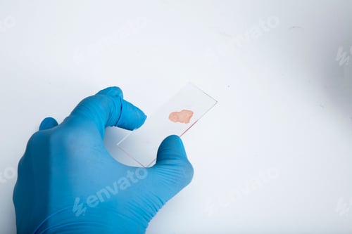 Preview: Scientist conducting a medical experiment in a laboratory, holding a test sample