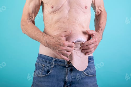 Preview: stoma care