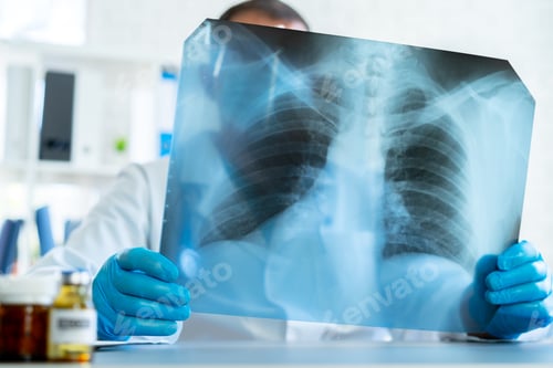 Preview: Doctor examining lungs x-ray scan in his office in hospital