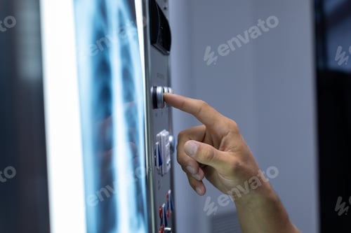Preview: Close-up of Caucasian surgeon operating light box in operation theater at hospital