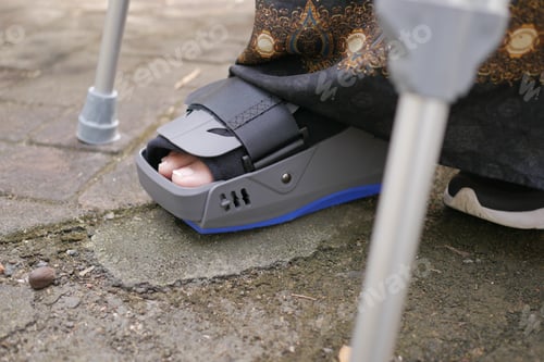 Preview: women broken feet with a grey plastic boot ankle brace injury protecting boot