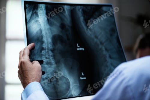 Preview: A doctor with a patient's x-ray film