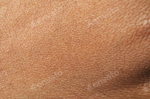 Preview: Macro view of normal skin as background