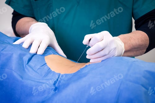 Preview: Infiltration for lumbar hernia