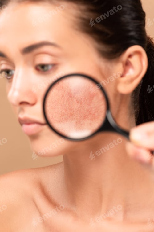 Preview: selective focus of man holding magnifier near naked woman with problem skin isolated on beige