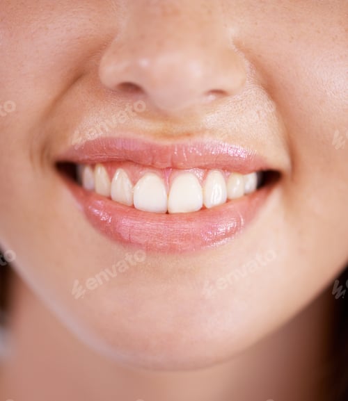 Preview: Taking care of her teeth