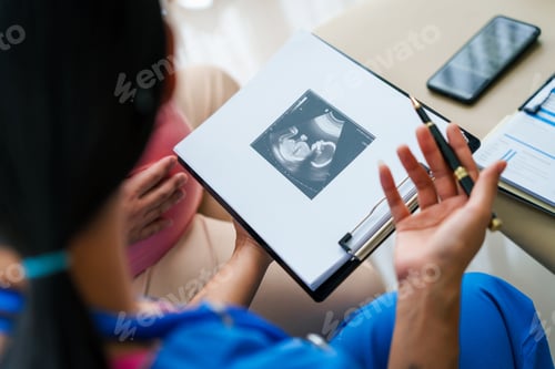 Preview: Asian female doctor and nurse consult with pregnant woman on sofa, using ultrasound and stethoscope