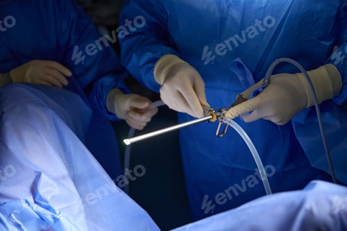Preview: Close up of medical team performing surgery in operating room, using surgical laparoscopy equipment