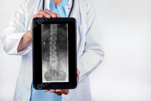 Preview: Male physician holding a vertical tablet with an X-ray radiograph of a spine