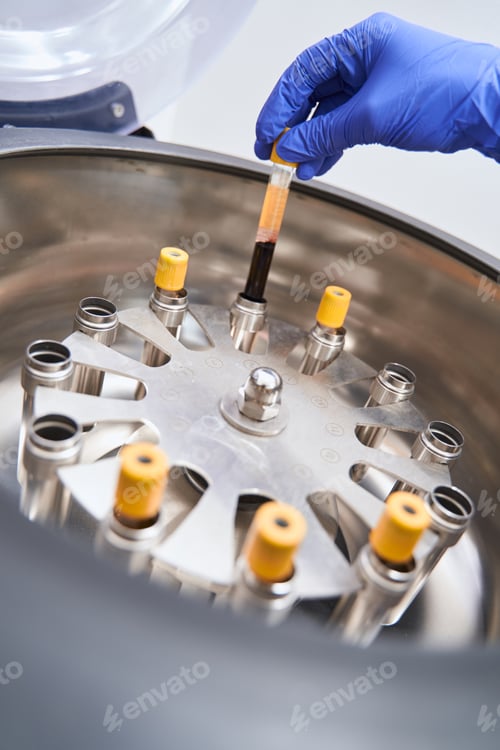 Preview: Nurse doing medical research with centrifuge in hospital
