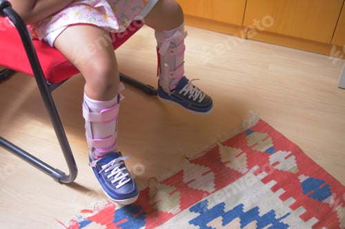 Preview: Child cerebral palsy disability with legs orthosis shoes sitting on a chair