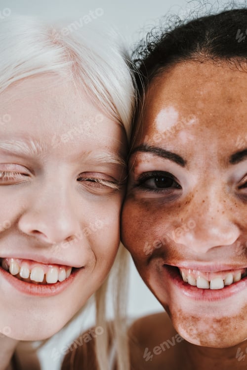 Preview: Group of multiethnic women