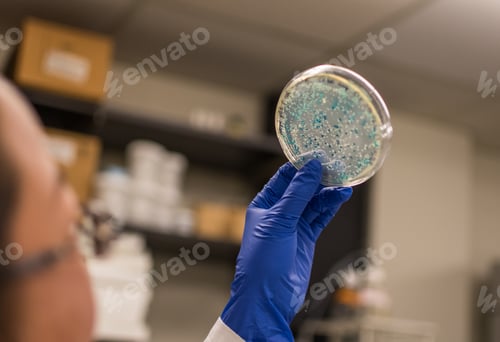 Preview: Examination of bacterial colonies in culture plate