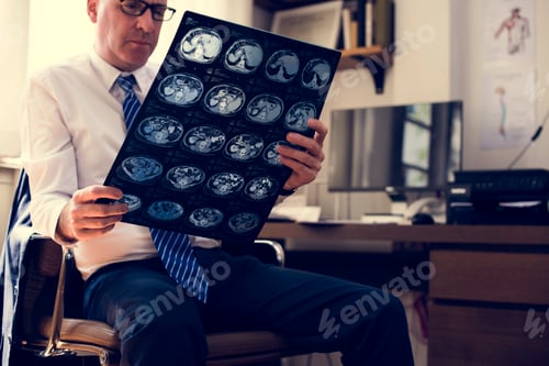 Preview: Brain CT scan x-ray film