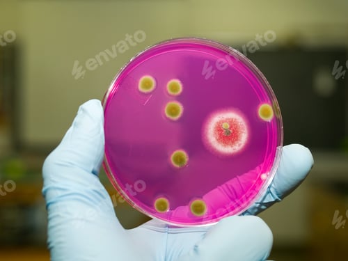 Preview: Scientist viewing molds growing on an agar plate.