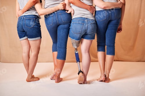 Preview: Rear View Of Body Positive Diverse Casually Dressed Women Friends One With Prosthetic Limb