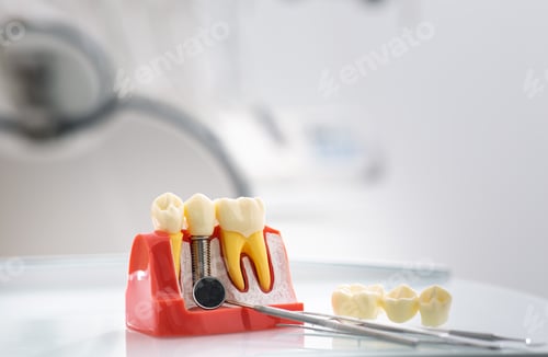 Preview: Detailed tooth model showcases the layers of enamel and dentin in a bright dental office