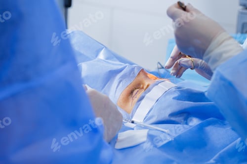 Preview: Upper eyelid blepharoplasty suturing under sterile drapes in ophthalmic theatre