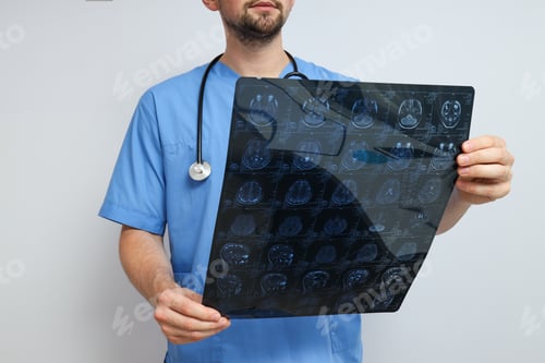 Preview: MRI images of a human head in the hands of a doctor