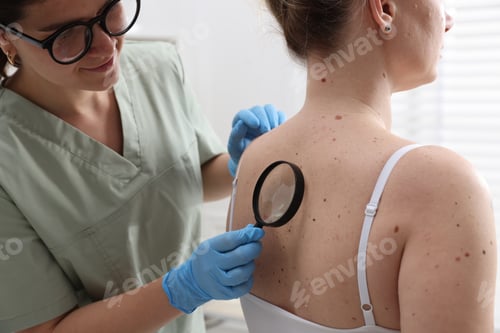 Preview: Doctor examining woman's moles in hospital, closeup