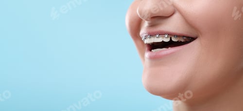Preview: Smiling woman with braces on light blue background, closeup. Banner design with space for text